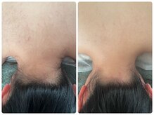 クランシュプール 恵比寿店/【うなじ／襟足】