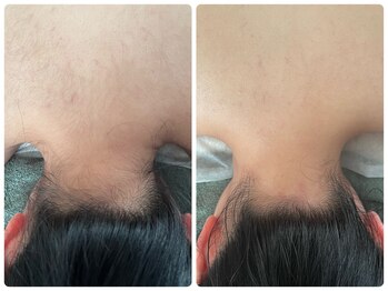 クランシュプール 恵比寿店/【うなじ/襟足】