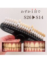 ブリエ(BRILLER)/《医》高効果ホワイトニング症例