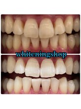 ホワイトニングショップ 越谷店/