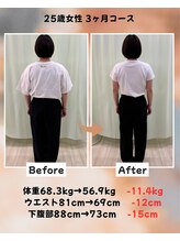 くさば整骨院/25歳女性/ダイエット3か月コース