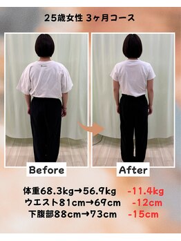 くさば整骨院/25歳女性/ダイエット3か月コース