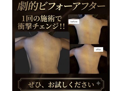 ハレ(hale)の写真