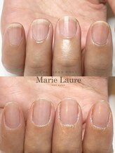 マリーロール 梅田店(Marie Laure)/自爪育成/深爪矯正/ネイルケア