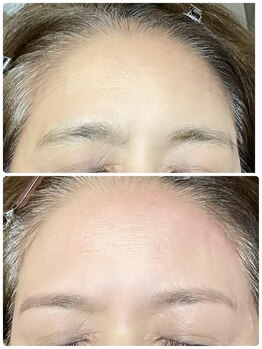 ビューステージ アイブロウサロン 吉祥寺/額ワックスもあります