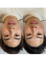 ビトタン 倉敷本店(+美to鍛)/お顔とのバランス◎