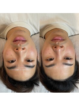 ビトタン 倉敷本店(+美to鍛)/お顔とのバランス◎