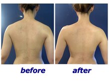 アンプリール(emplir)/サイズダウン