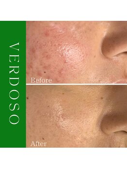 ハナイロ(hana-iro)/ベルドソ管理