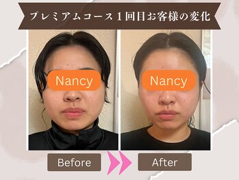 ヨサパーク ナンシー(YOSA PARK Nancy)