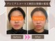 ヨサパーク ナンシー(YOSA PARK Nancy)の写真