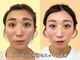 ナチュラルパーフェクトフェイス 新宿の写真