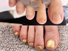 グラシナ なんば店/深爪/自爪育成/フィルイン