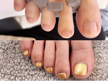 グラシナ なんば店/深爪/自爪育成/フィルイン