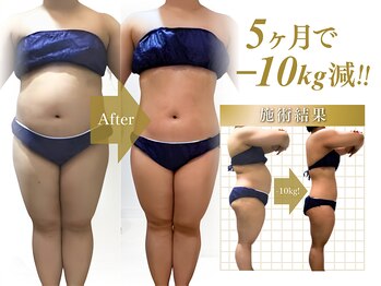 レイビス 札幌店(RAYVIS)/お客様ビフォーアフター