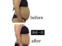 ビンナ 五反田店(Binna)の雰囲気(自己流ダイエットで結果が出ないならプロの手にお任せを♪)