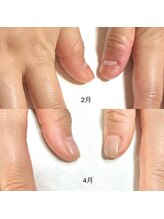 リンク(LINK)/お爪の変化