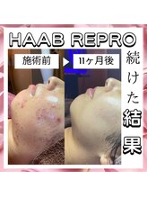 マリー(Mary.)/11か月後