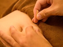 エクステンド鍼灸整体院(extend鍼灸整体院)/刺さない鍼