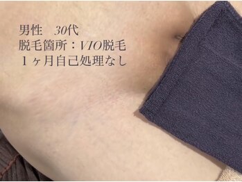 ホッコリ 段原店(HOKKORI)/話題のフェムケア