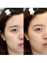 チル アンド アイ 船橋駅前店(Chill&Eye)/美眉スタイリング/BeforeAfter