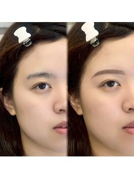 チル アンド アイ 船橋駅前店(Chill&Eye)/美眉スタイリング/BeforeAfter