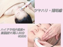 ビベロ 池袋(美BELLO)