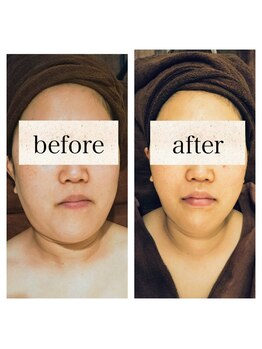 エステサロン カラーズ(COLORS)/小顔得意です