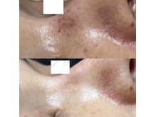 ニュアージュ(Nuage)