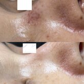 ニュアージュ(Nuage)