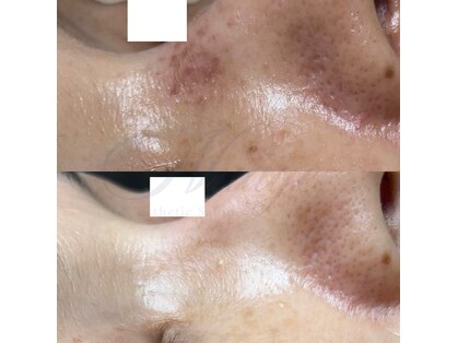 ニュアージュ(Nuage)の写真