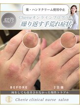 シェリー(Cherie)/長年悩む慢性皮膚トラブル改善