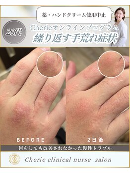 シェリー(Cherie)/長年悩む慢性皮膚トラブル改善