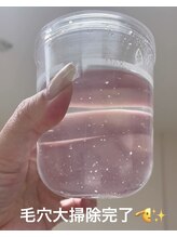 プルメリア(Plumer’a)/毛穴汚れ・黒ずみチェック！