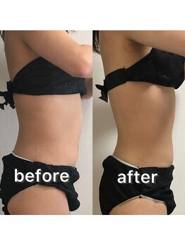 ベルフィーヌ 北千住店(BELFINE)/ボディーコースビフォーアフター