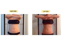 キナーレ 大宮(Kina-re)/