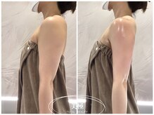 美極 トータルビューティー(美極 TOTAL BEAUTY)/恵比寿/痩身エステ