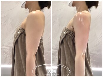 美極 トータルビューティー(美極 TOTAL BEAUTY)/恵比寿/痩身エステ