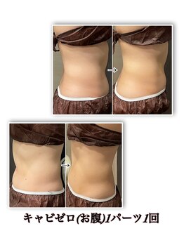 ルアナライフ(Luana Life)/キャビゼロでくびれ作り！