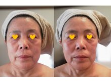 サロン ド トゥシャン(Salon de touchant)の雰囲気（小顔キュ！たるみとむくみに働きかける筋膜リリース）