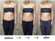 ミヌレ 大阪店(minulle)/太ったのに痩せて見える？