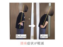 整体あゆむ 立川店/before after９