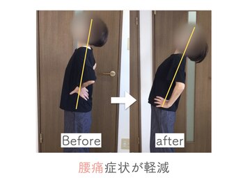 整体あゆむ 立川店/before after９
