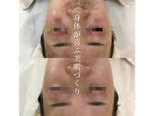 シャルル ストア 京都三条通(Chaleureux Store)の雰囲気（揺らぎやすい3～5月も、肌に合わせたケアで肌調子を底上げ◎）