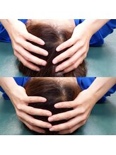 エビサン整体院 八丁堀店/頭蓋骨小顔矯正