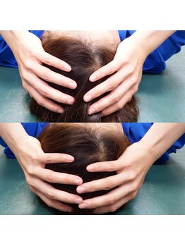 エビサン整体院 八丁堀店/頭蓋骨小顔矯正