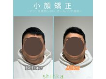 シンカ 湘南江ノ島 鵠沼(shinka)/【小顔矯正】メンズもＯＫ