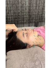 ティーナ(T'ina)/鍼灸
