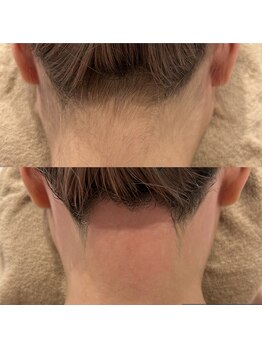 アンビジュ(un bijou)/浴衣が似合う★うなじ美人★