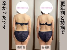 モモナ(Momona)/#肩こり#リンパマッサージ#野並